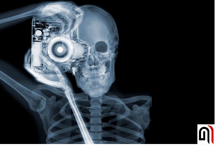 Рентгеновское излучение